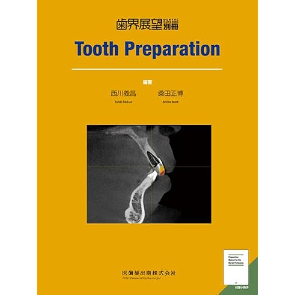 Clinical Provisional Restoration: VISUALプロビジョナル・レスト